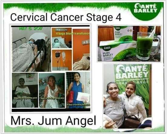 Sante Barley - Cervical Cancer Stage 4 Testimonial